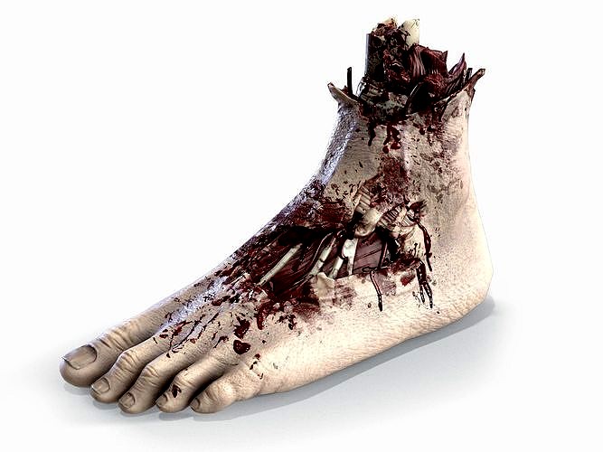 Severed foot