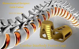 lumbar interbody fusion cage
