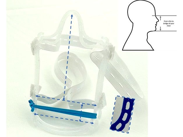 Anti Fog Surgical Mask Brace - Adjustable - Fast Batch Stack Print by FullPlasticScientist