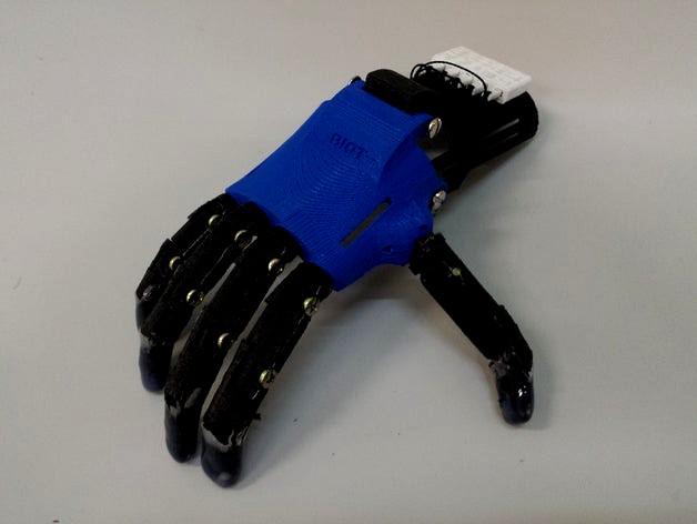 BIOT hand prosthesis by BiomecanicaIOT