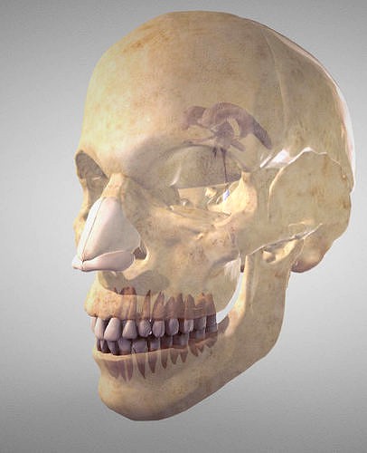 Skull And Ventricles of the brain