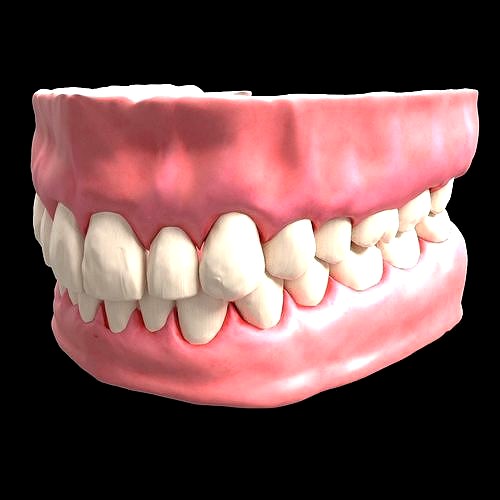 denture