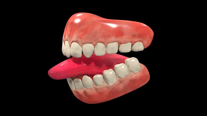 Teeth Denture