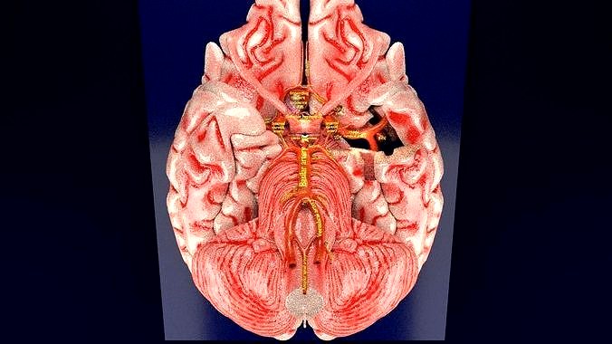 Cerebral aneurysms berry circle of willis