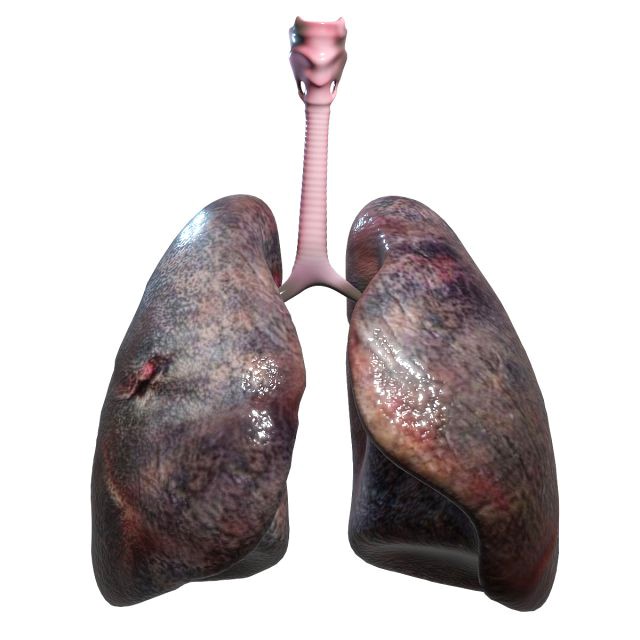 Smokers Lungs