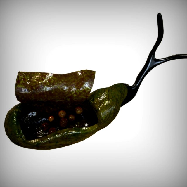 Gallbladder Anatomy