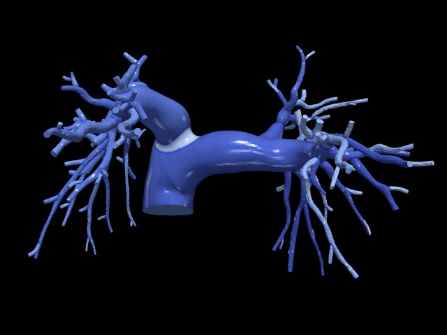 Pulmonary arteries