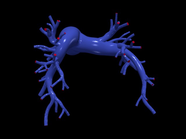 Pulmonary arteries