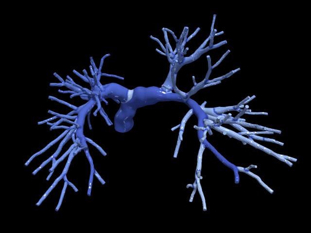 Pulmonary arteries