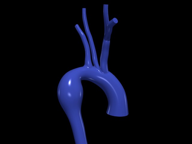 Aorta