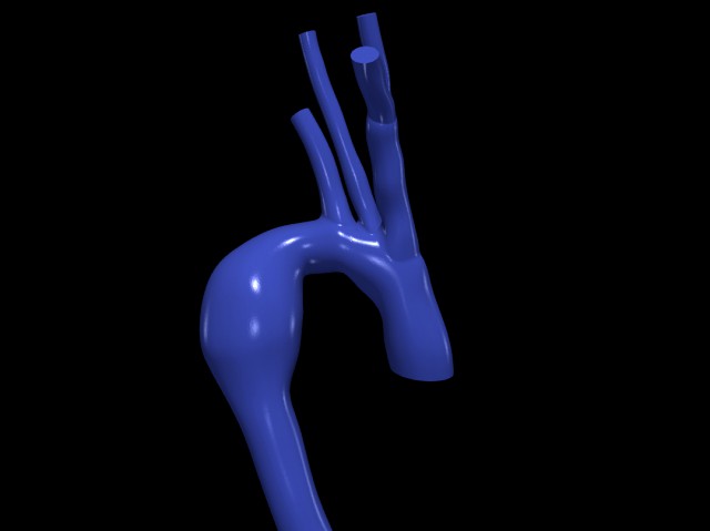 Aorta