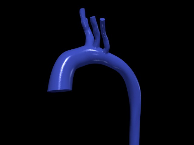 Aorta