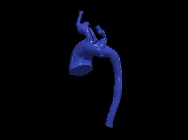 Aorta