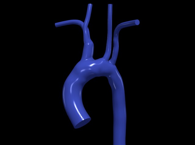 Aorta