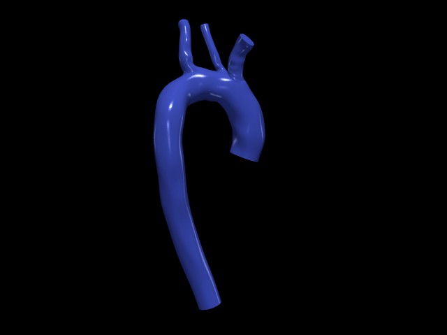 Aorta