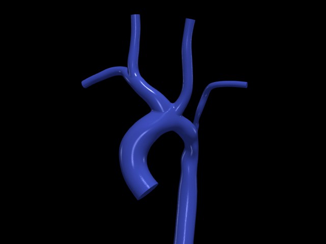 Aorta