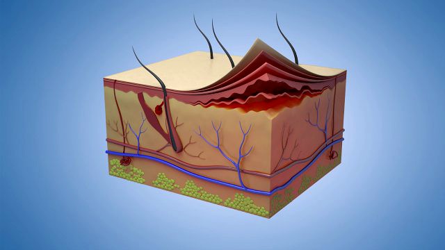 Skin Parts Anatomy cross sections cells cortex hair follicles
