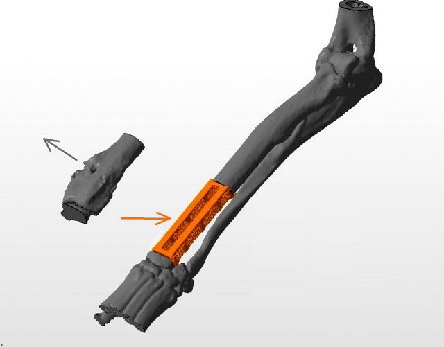 an example of a real organ-preserving operation for osteosarcoma