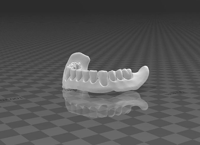 Tooth