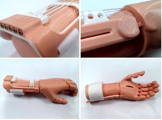 traction arm prosthesis