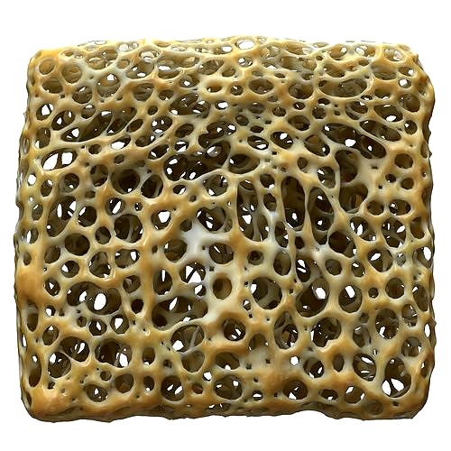 Bone Matrix Rectangle