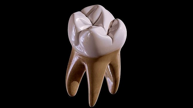 Maxillary First Molar