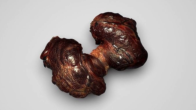 Thyroid Gland