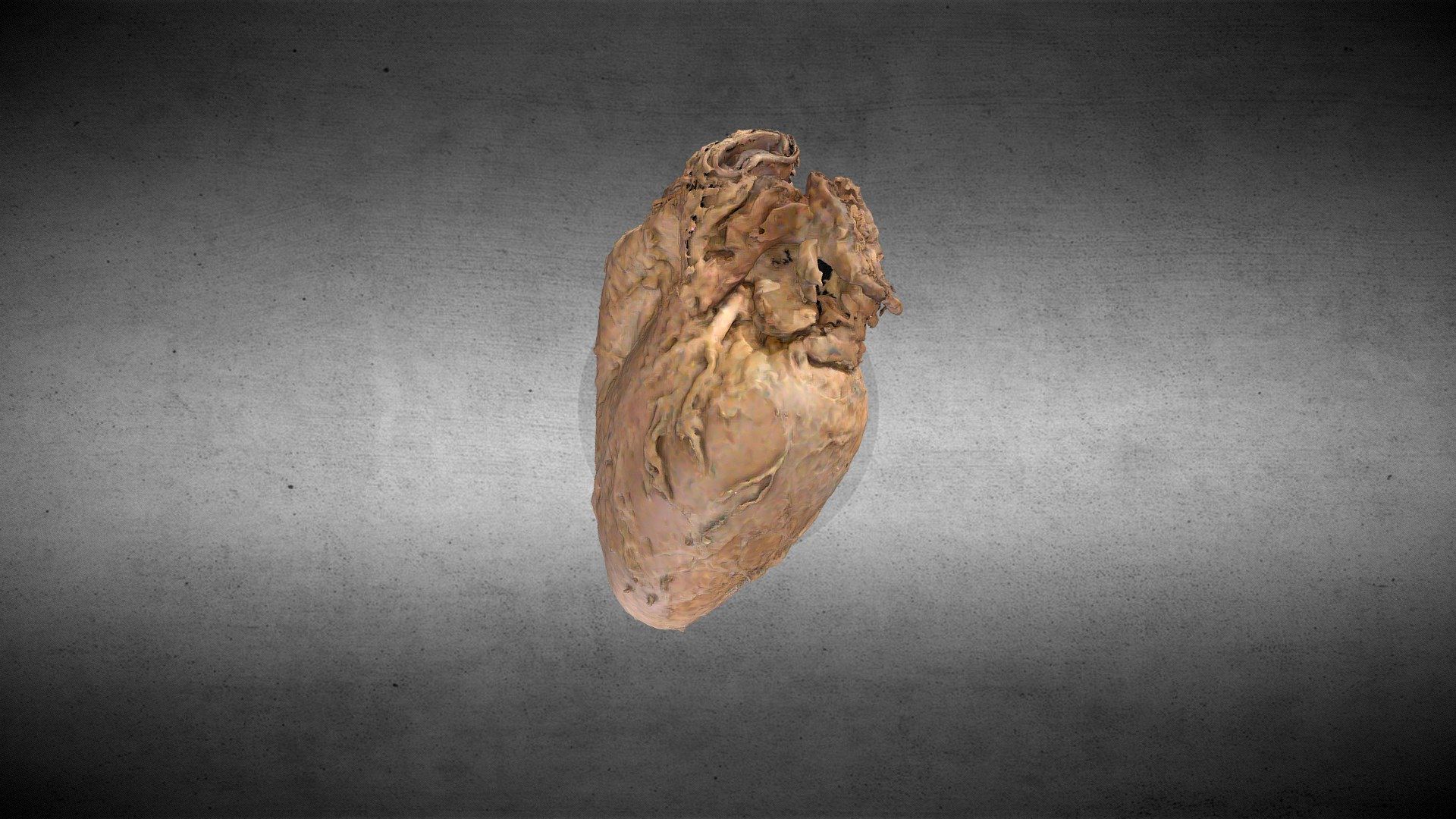 Corazón Humano/Human Heart
