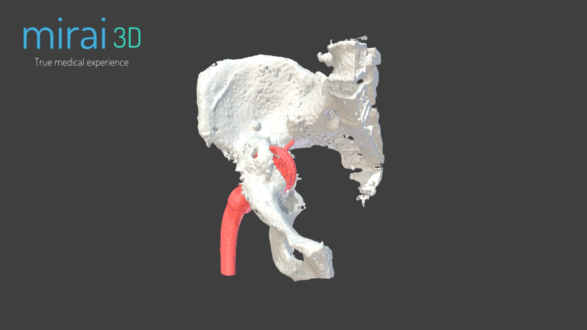 Medical Model WP7