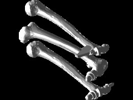 Reflex Hammers