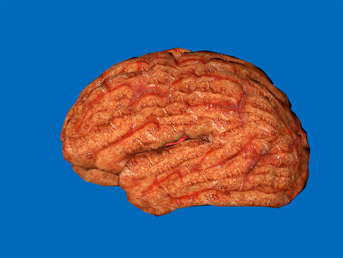 Brain