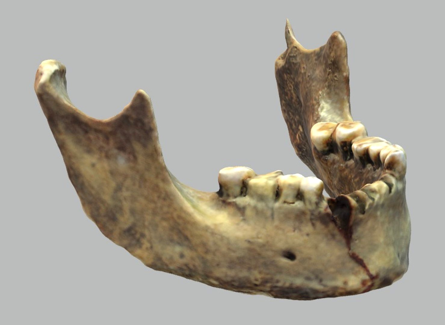 Human's jaw