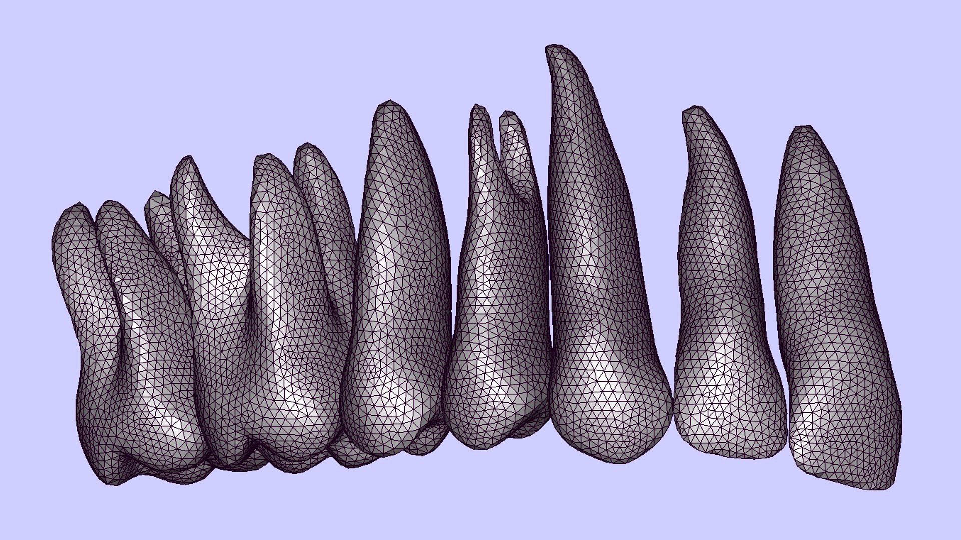 Maxilla Teeth