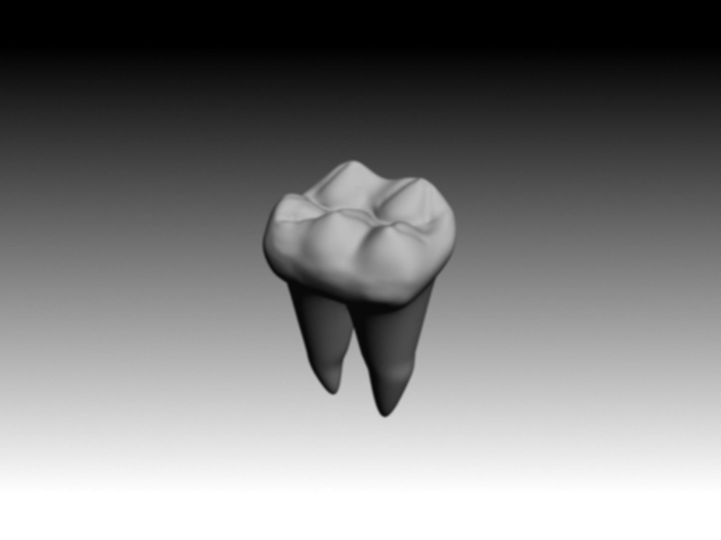 first molar mandibular.3DS