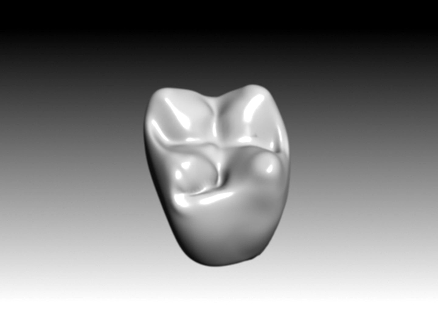 second molar maxilar crown.3DS