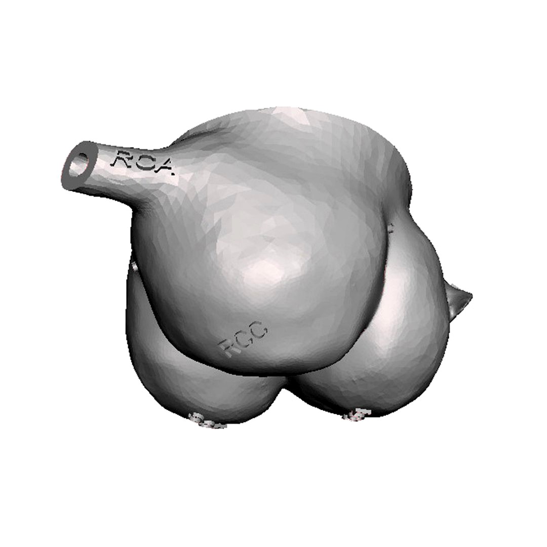 Aortic valve