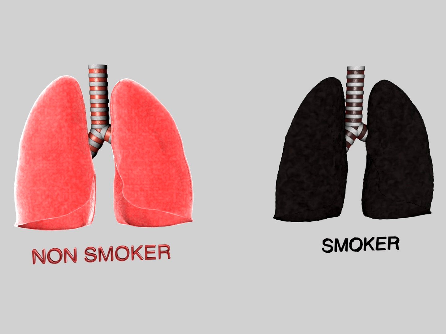 Lungs Human Smoker vs Non Smoker