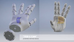 yes you CAN - prosthetic terminal device