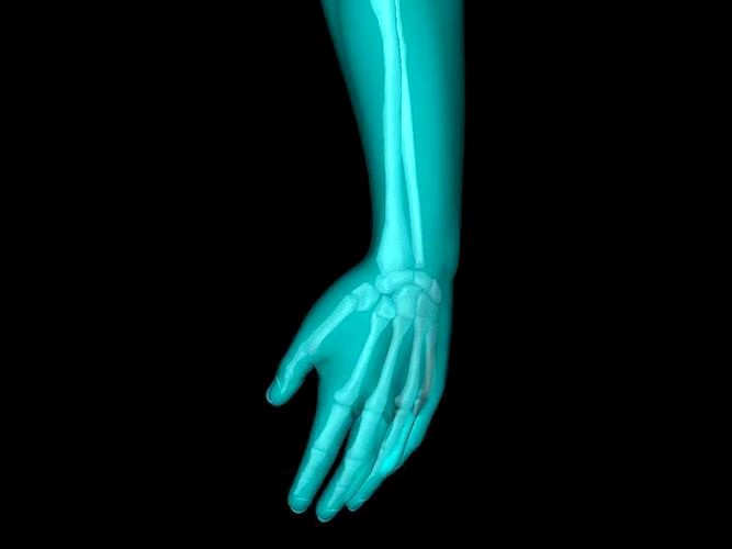 X Ray Hand Medically Accurate 3d Model