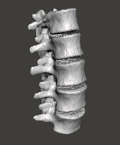 Lumbar Spine - male