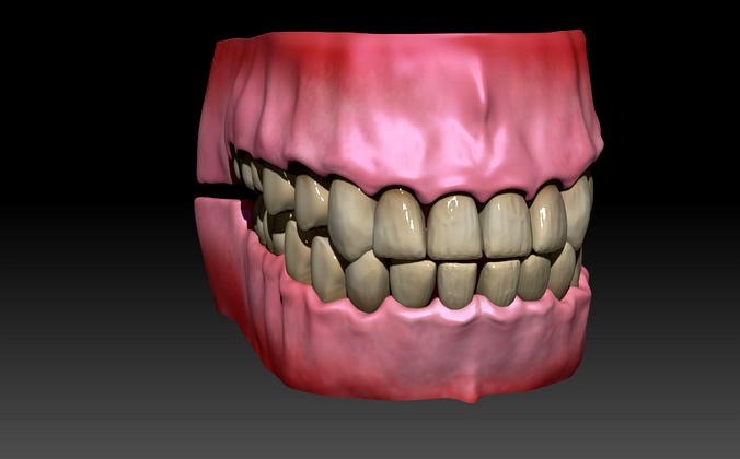 Gums and teeth