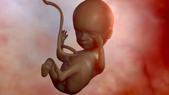 Fetus