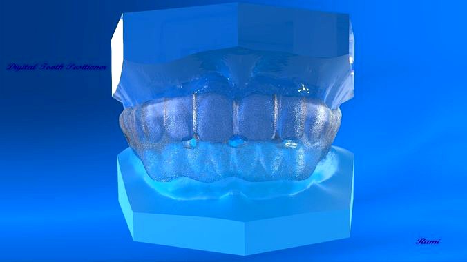 Digital Ortho Tooth Positioner | 3D