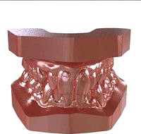 Digital Study Orthodontic Archman Model