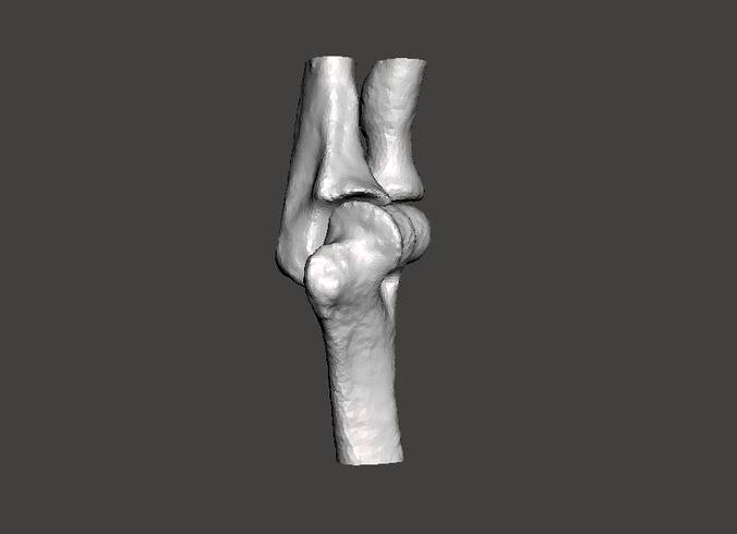 Left elbow - female - age 37