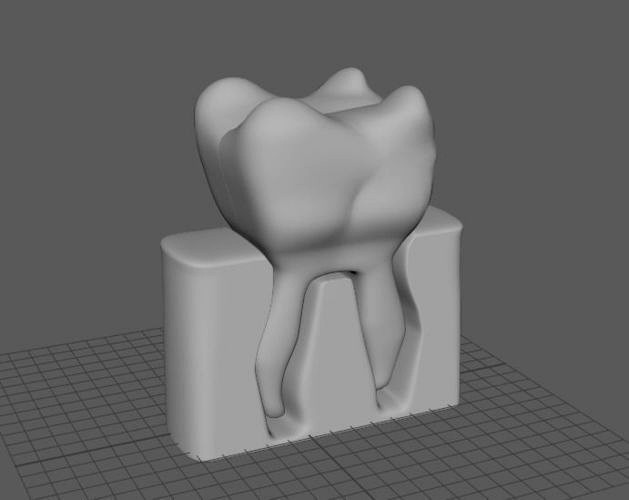 Printable Tooth | 3D