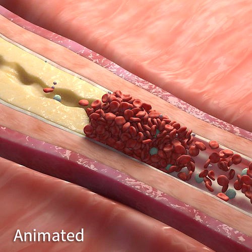 Fat Clot in BloodStream Animation