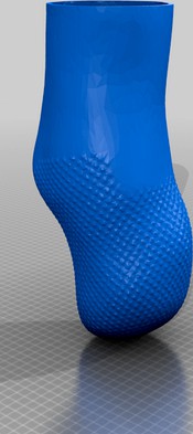 TILS System  (Textured Interlocking Liner Socket System)