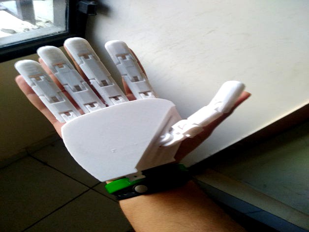 Prosthetic arm