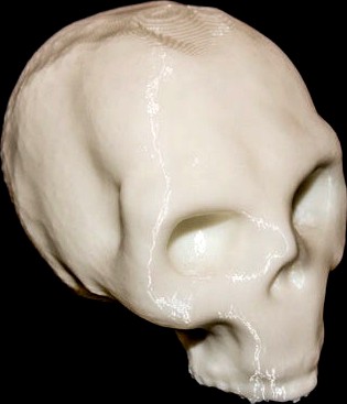 Human Skull